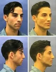 Masculinización facial: ciencia, estructura y equilibrio bioestético para la piel masculina